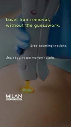 Milan Laser one price certainty creative