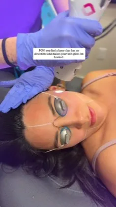SkinSpirit laser facial promotion creative