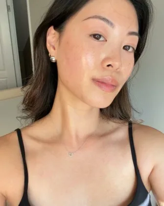 SkinSpirit PDRN microneedling creative